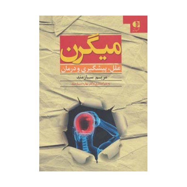 میگرن (علل،پیشگیری و درمان)