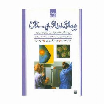 بیماری های پستان (پزشک خانواده)